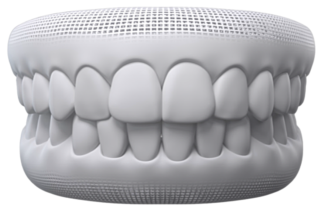 Diastema depois